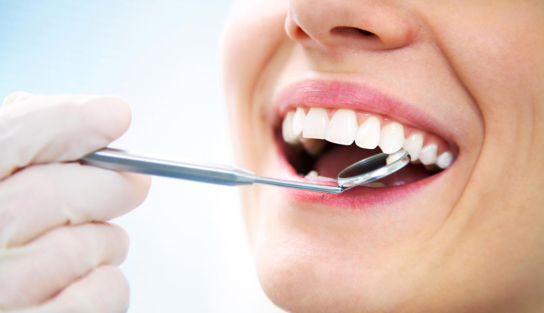 Professional Teeth Whitening Treatment