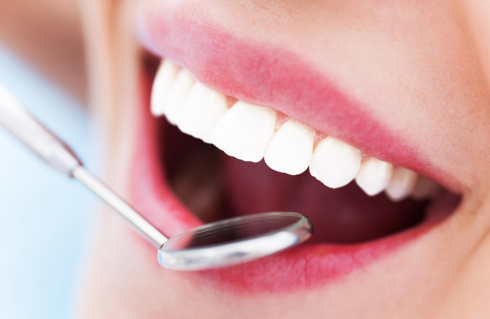 Basic Oral Health Checkup